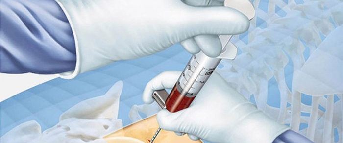 Особливості дії антианемічних препаратів